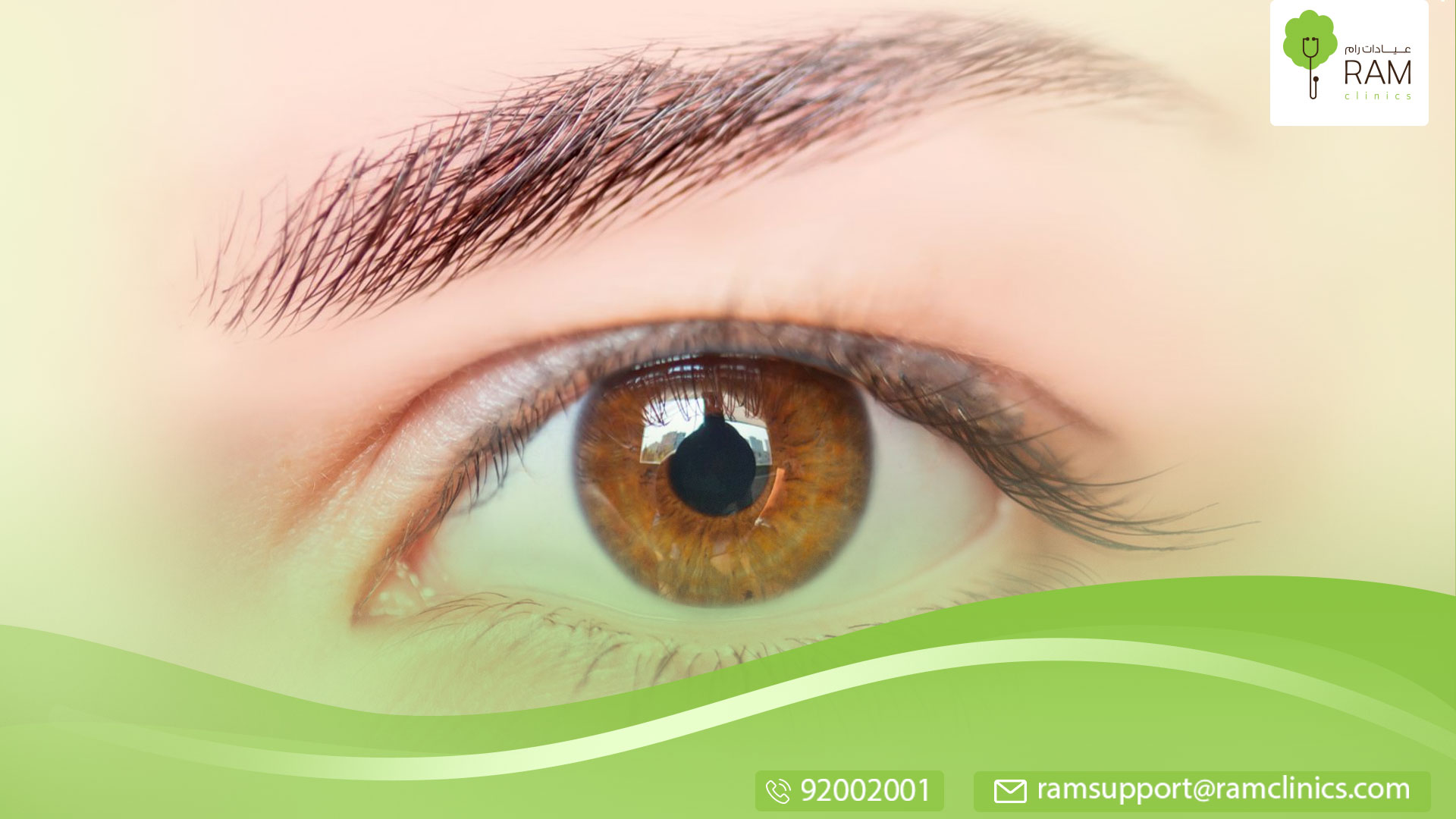 ما هو مرض عيون الراكون