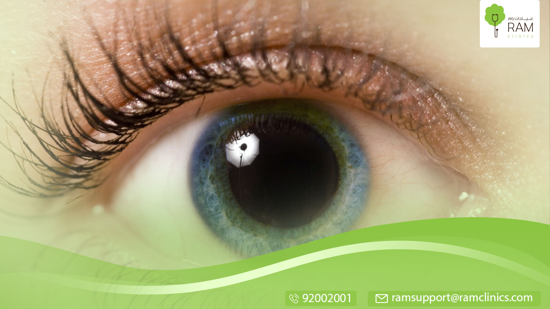 اسباب تغير لون العين