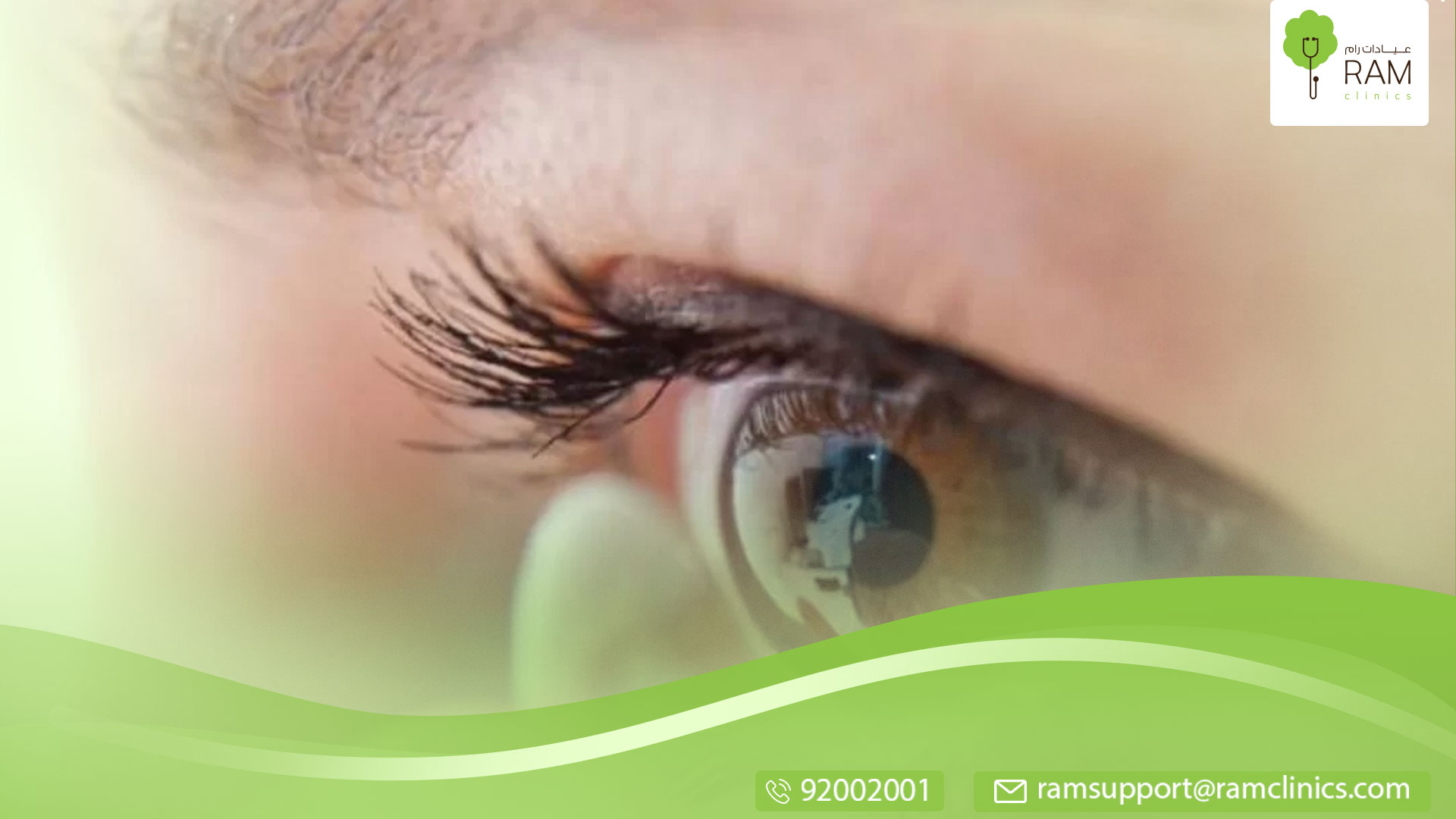 27 عدسة لاصقة عالقة في عين امرأة