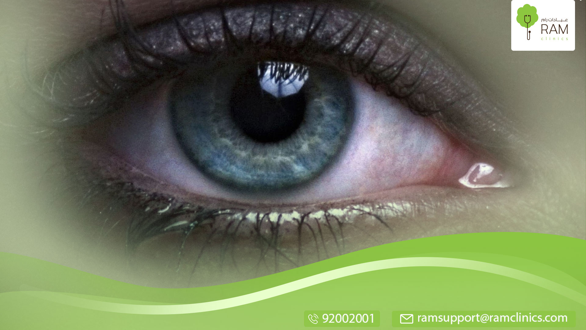 إزالة 14 دودة من عين إمراة في أمريكا