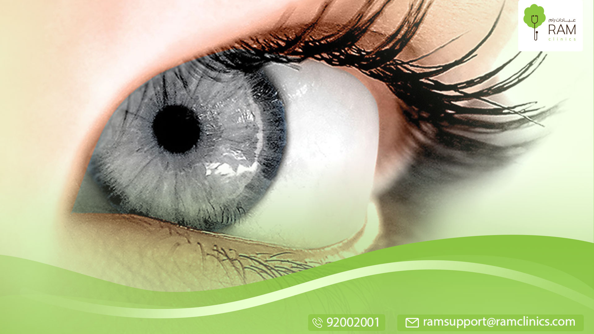 العين الوردية عند الرضع