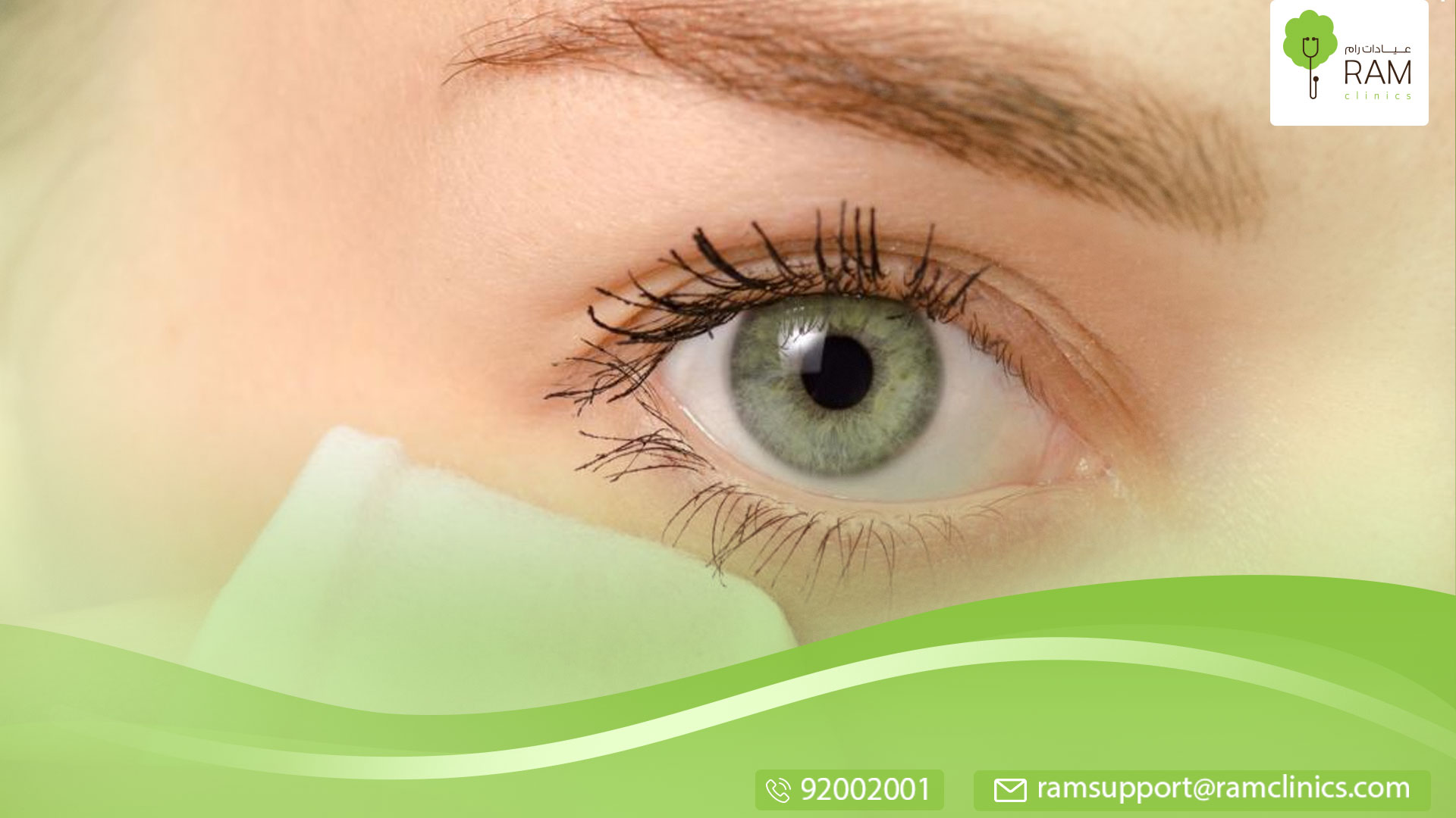 إفرازات العين