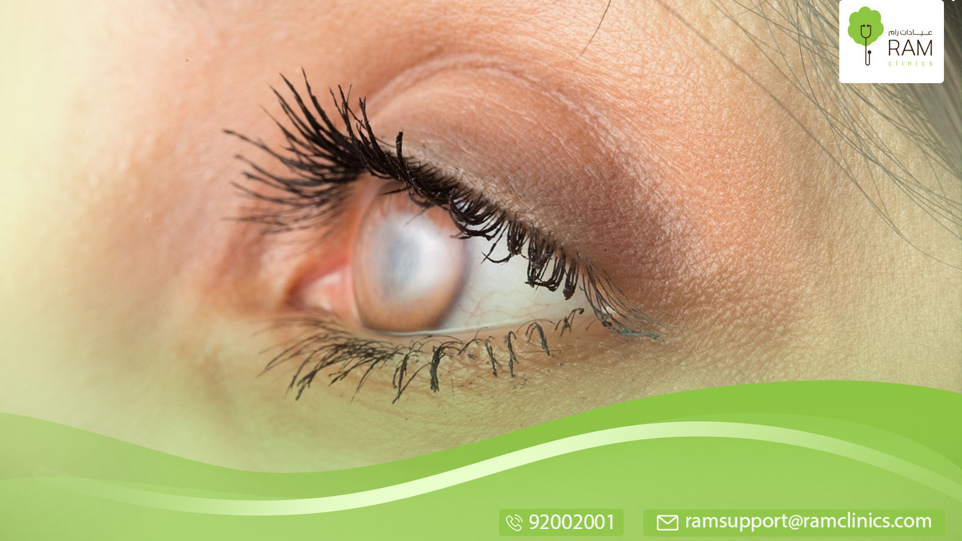 اسباب وجود دم في العين