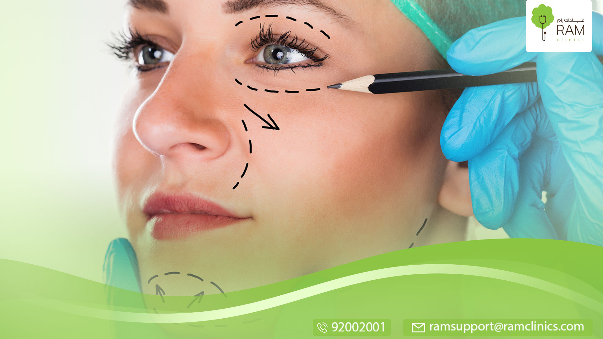جراحة رفع الحاجبين
