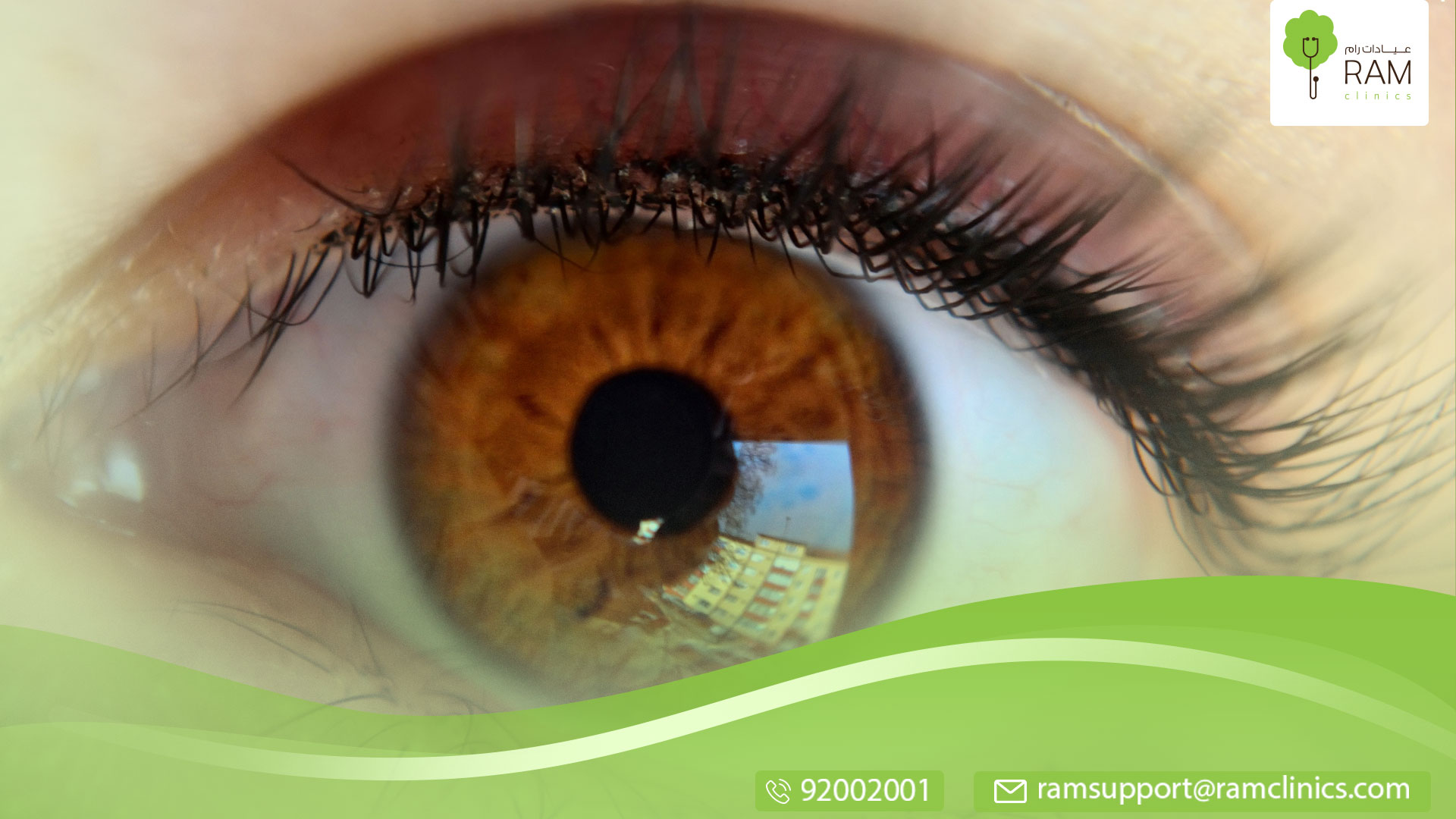 اسباب اعتلال الشبكية السكري