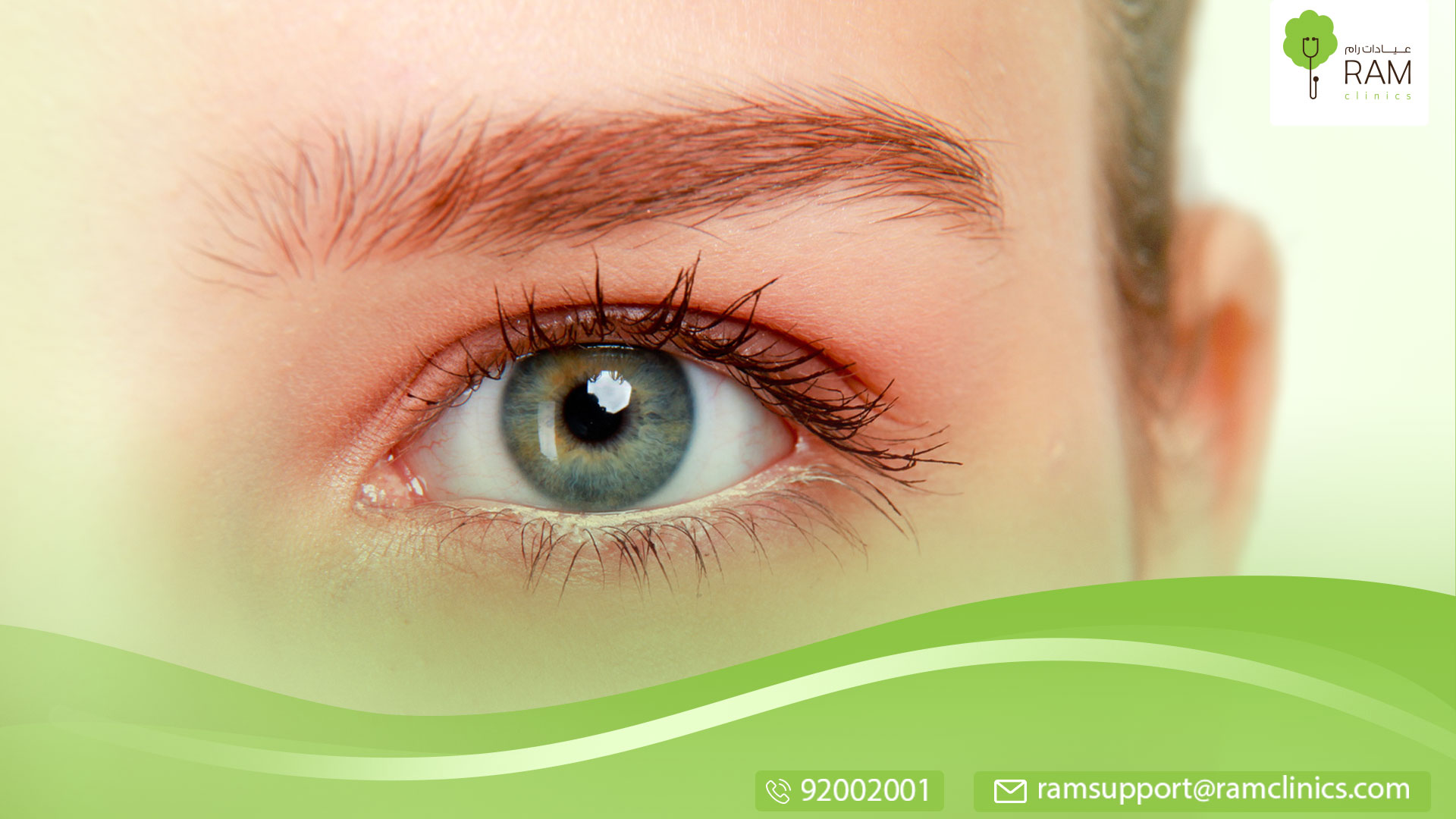 أمراض العين الفيروسية