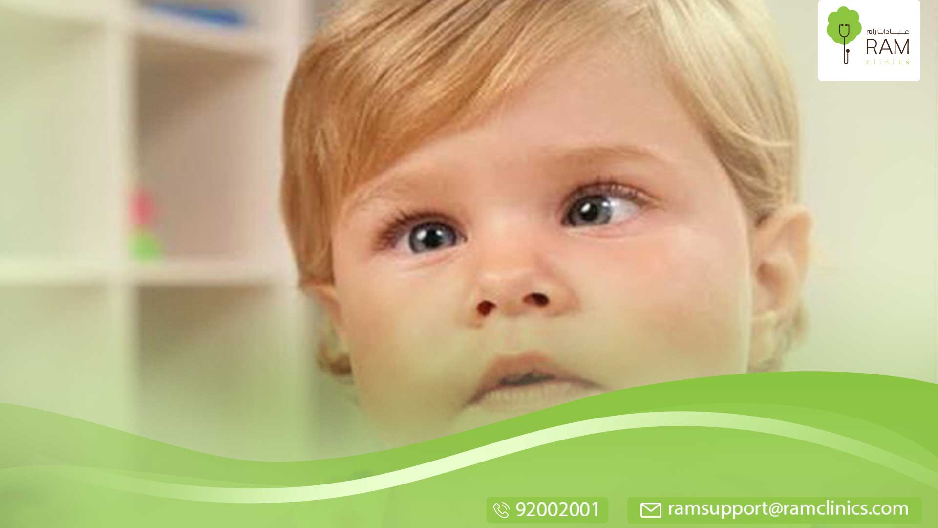 علاج الحول عند الأطفال