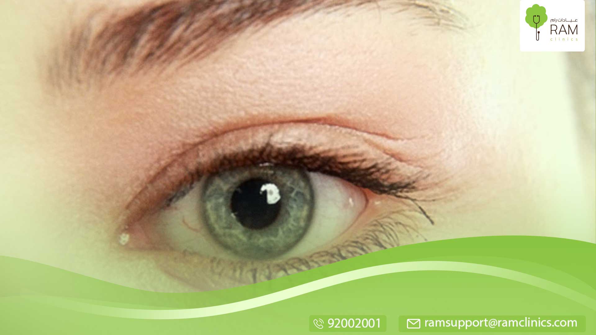 اسباب التهاب الجفن