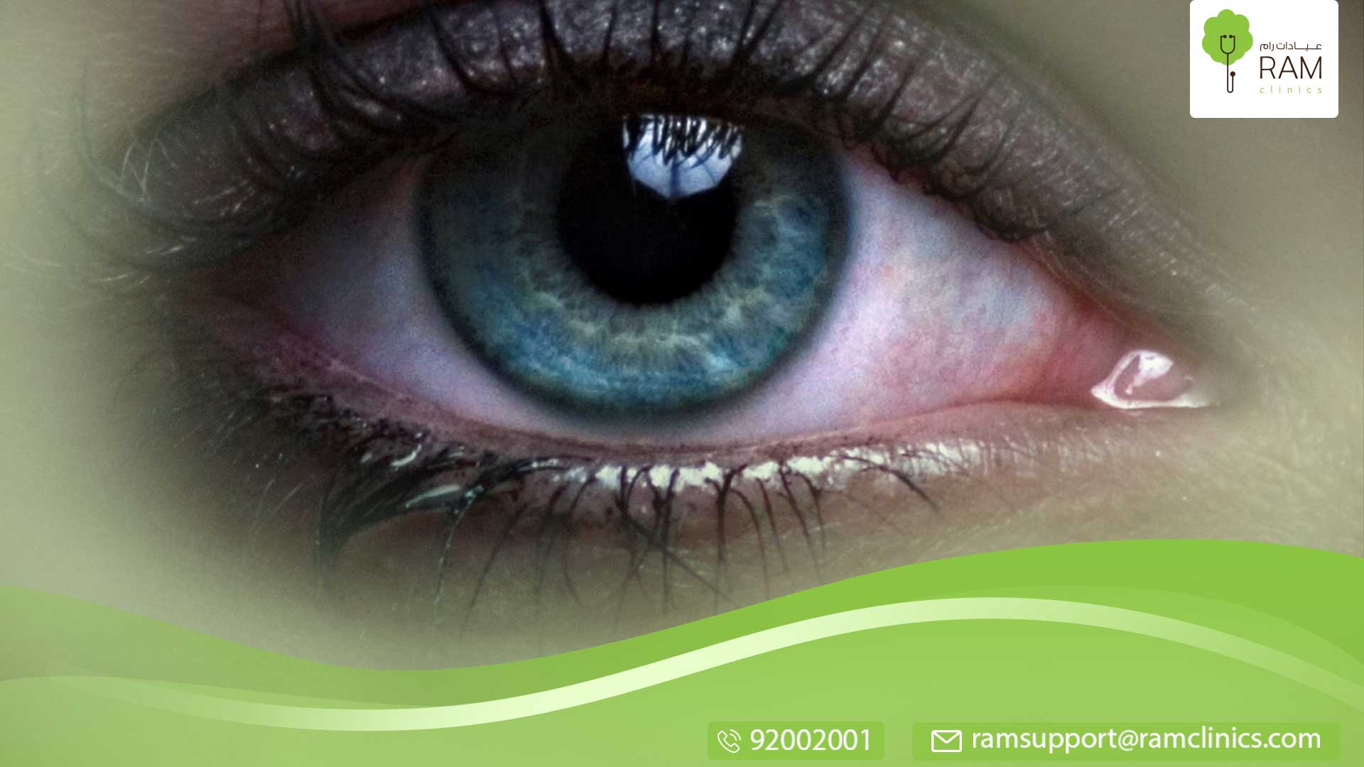 دموع العين المستمرة