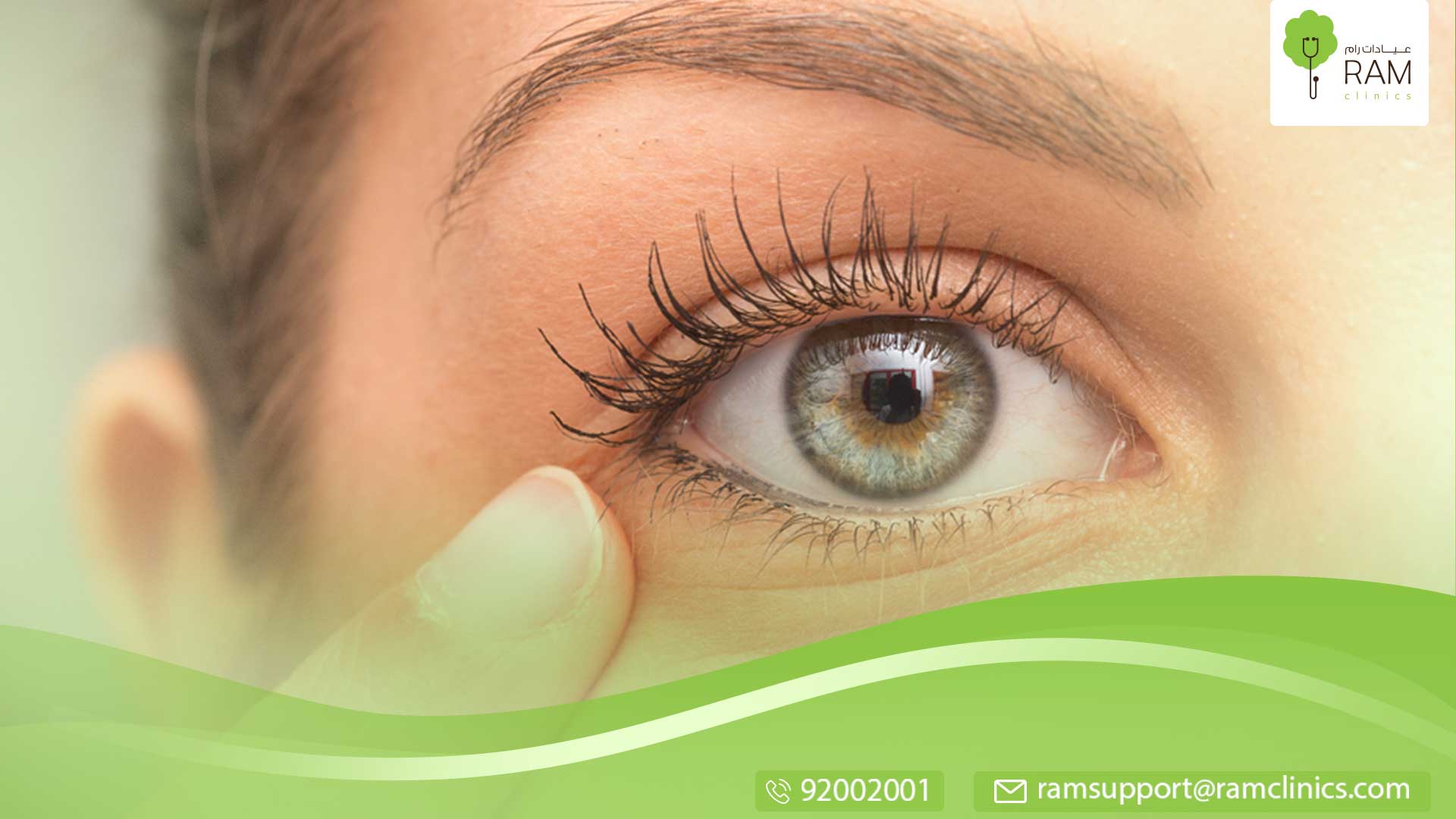 إفرازات العين الخضراء