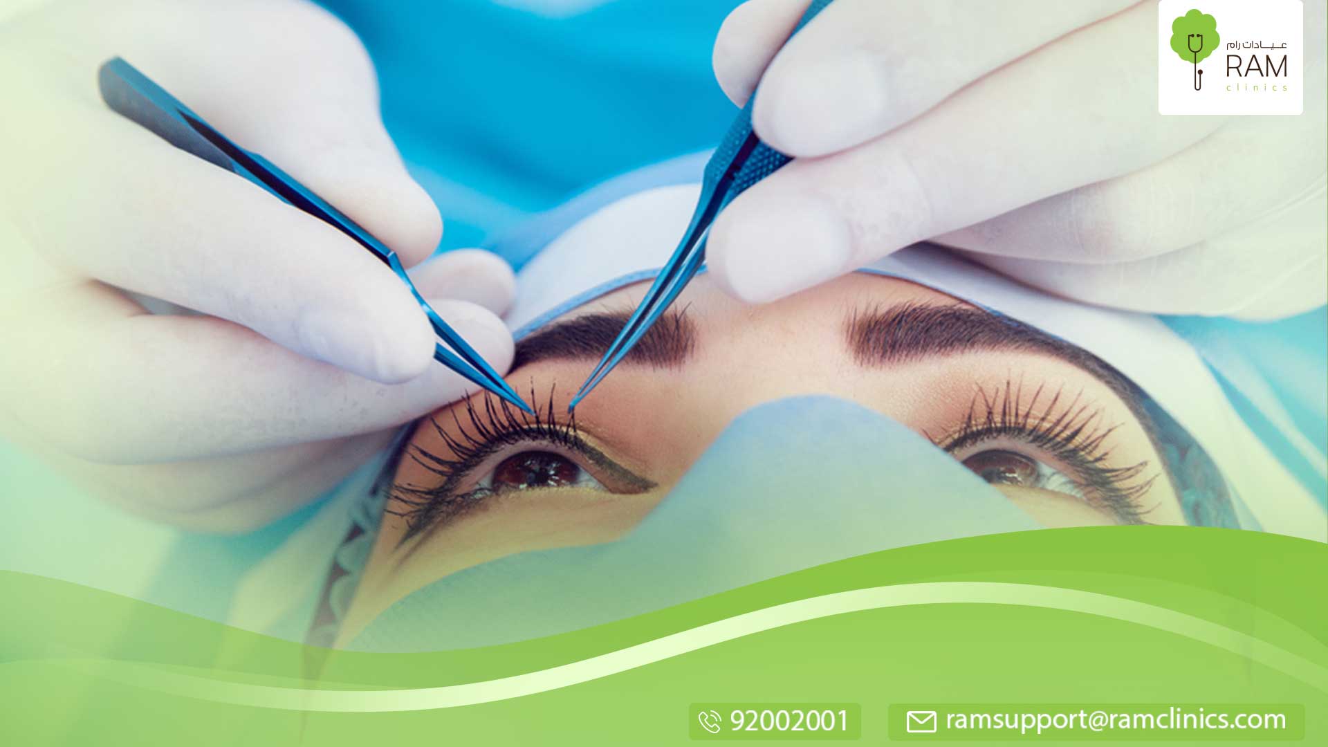 جراحة العيون بالليزر